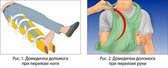 Домедична домога при переломах