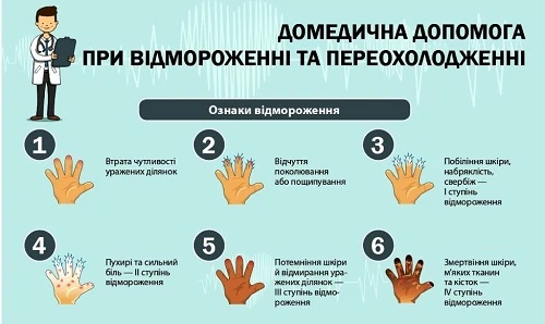 Як надати домедичну допомогу при обмороженні