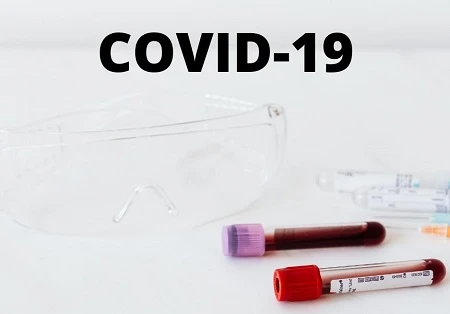 ПЛР-тестування для працівників: в яких випадках вимагати законно та хто має оплачувати ПЛР-тестування для працівників: в яких випадках вимагати законно та хто має оплачувати